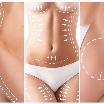 Combined procedures